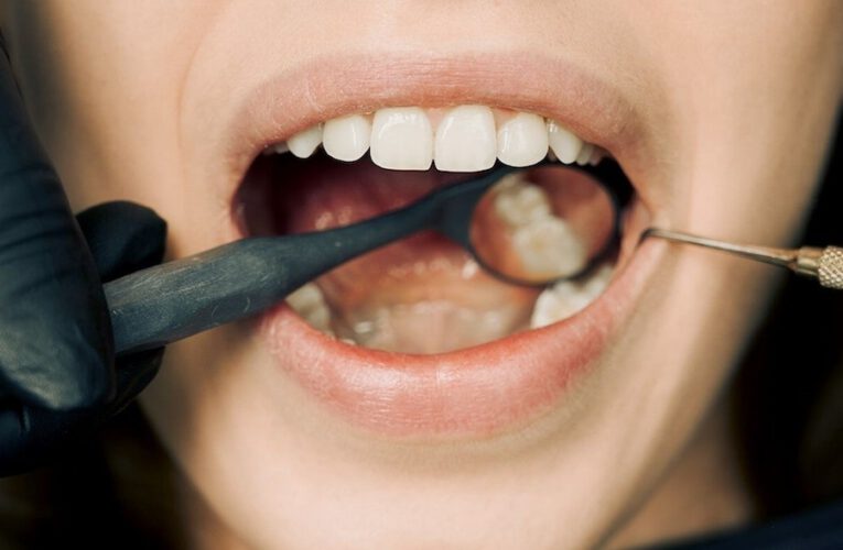 Implanty Kielce: Dla pięknych zębów
